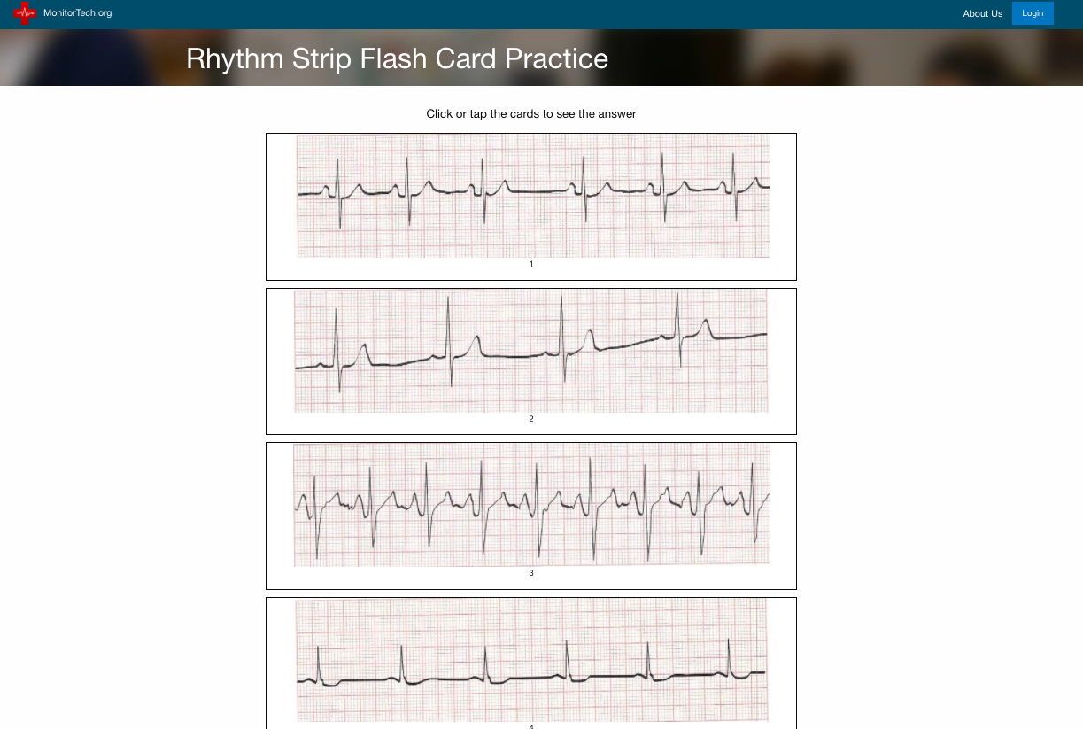 Rhythm Strip Flash Card Practice – CathLab.com